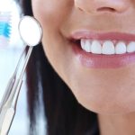 مراقبت‌های بعد از کامپوزیت دندان