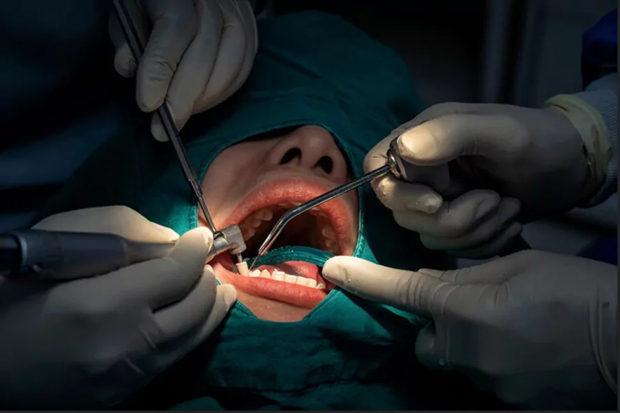 آیا جراحی دندان درد دارد؟