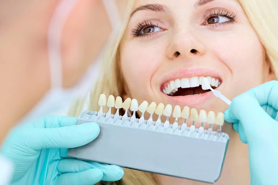 آیا نصب لمینت دندان باعث آسیب دندان های طبیعی می شود؟