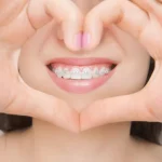 انواع روش‌های ارتودنسی دندان