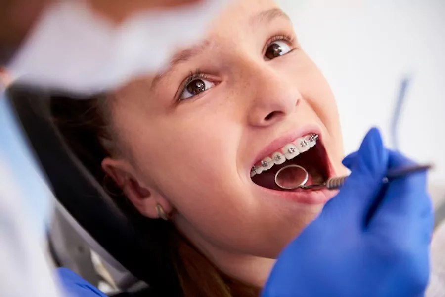 چه کسانی نباید ارتودنسی دندان انجام دهند؟