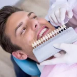 آیا لمینت دندان به دندان های طبیعی آسیب می رساند؟