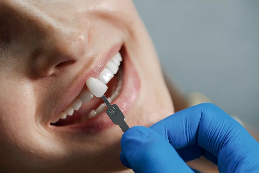 کاربرد های کامپوزیت دندان