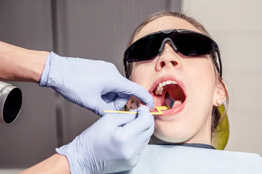 پروسه برداشتن دندان عقل به چه صورت است؟