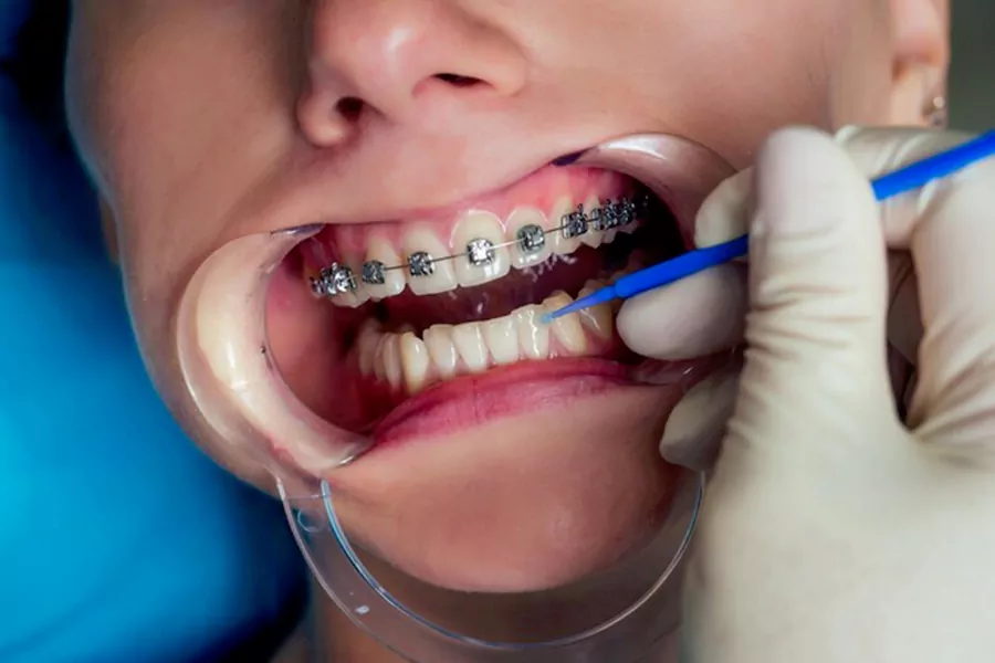 افزایش مشکلات دهان و دندان