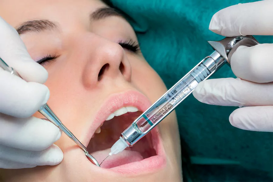 بیهوشی عمومی یکی از انواع بی حسی مورد استفاده در جراحی دندان