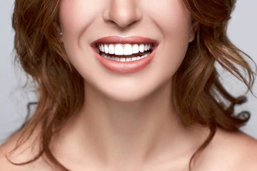 زیباترین لبخندها با کامپوزیت دندان