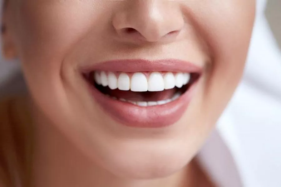 باندینگ دندان چه مزایا و معایبی دارد؟