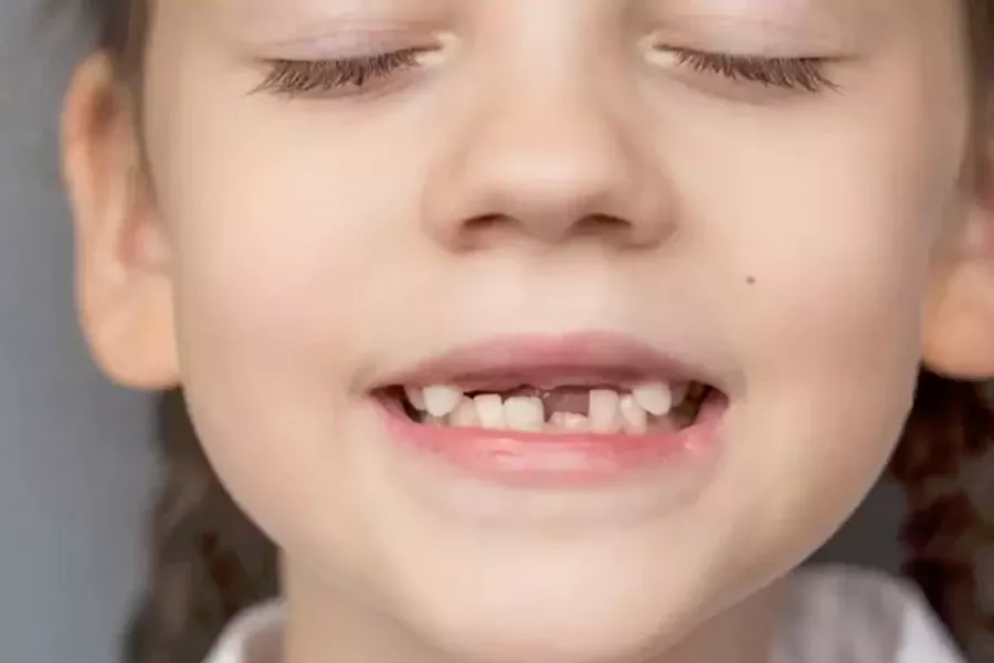 مزیت ارتودنسی دندان کودکان
