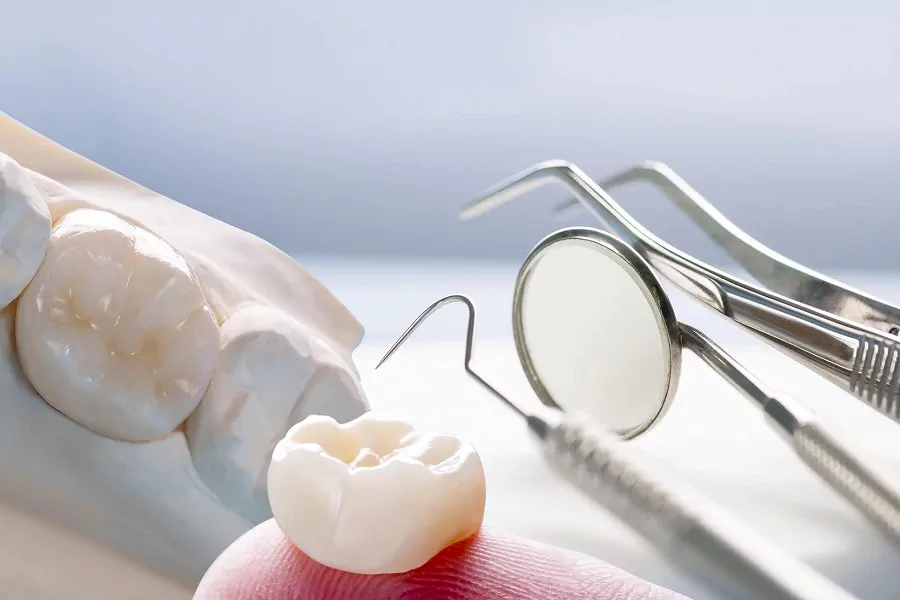 چه نکاتی را قبل از کشیدن دندان عقل باید بدانیم؟