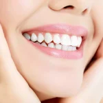 سفید کردن کامپوزیت دندان