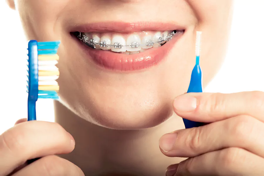 مزایای انواع ارتودنسی دندان