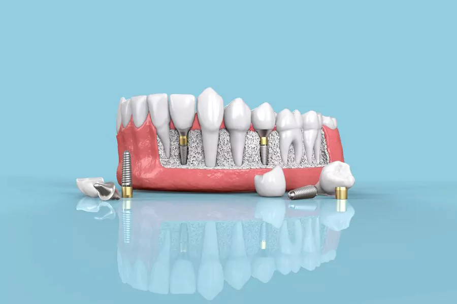 تجربه دندانپزشک