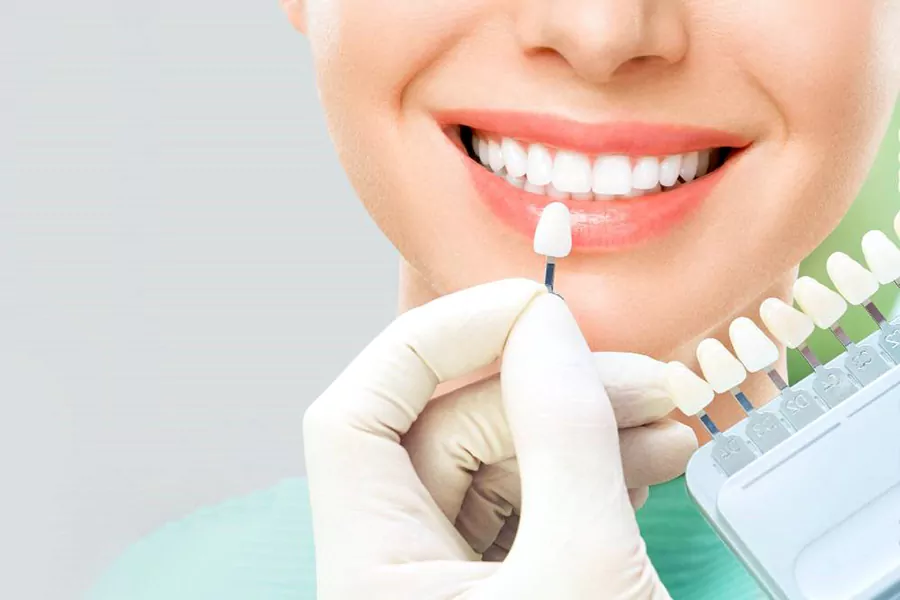 قبل از بلیچینگ دندان چه اقداماتی لازم است؟