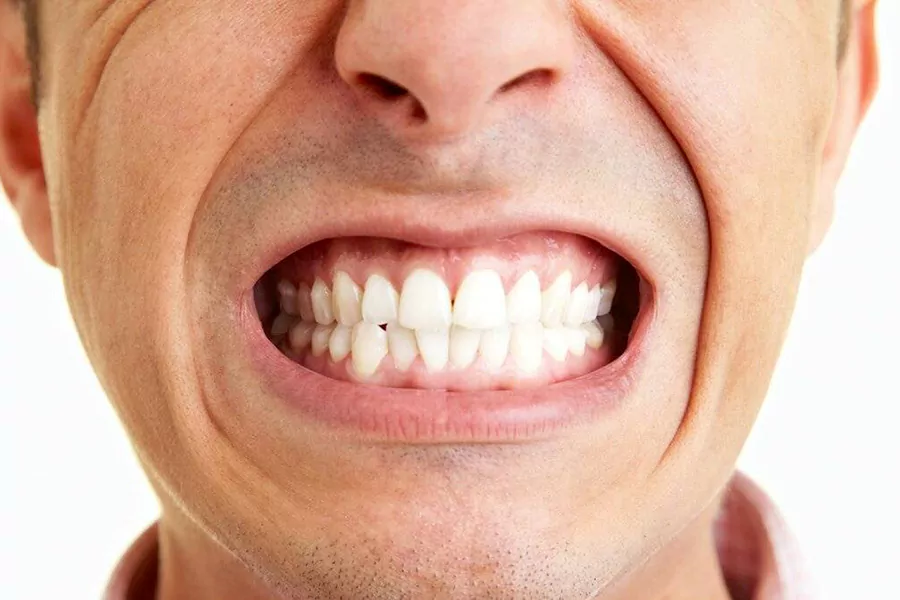 دلایل دندان قروچه چیست؟