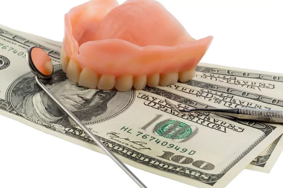 هزینه ونیر دندان چقدر است؟