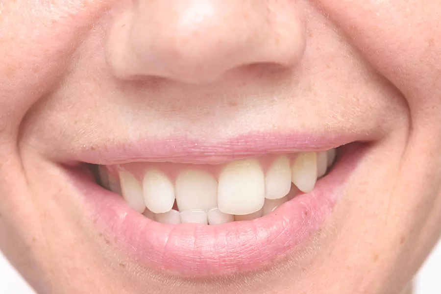 اصلاح مشکلات دندانی