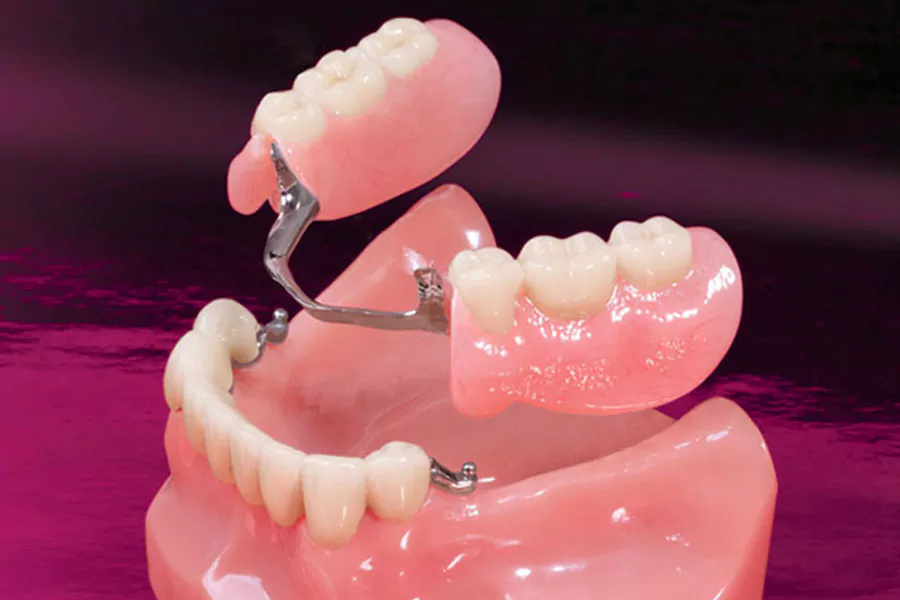 عدم مراقبت از دندان مصنوعی چه عوارضی دارد؟