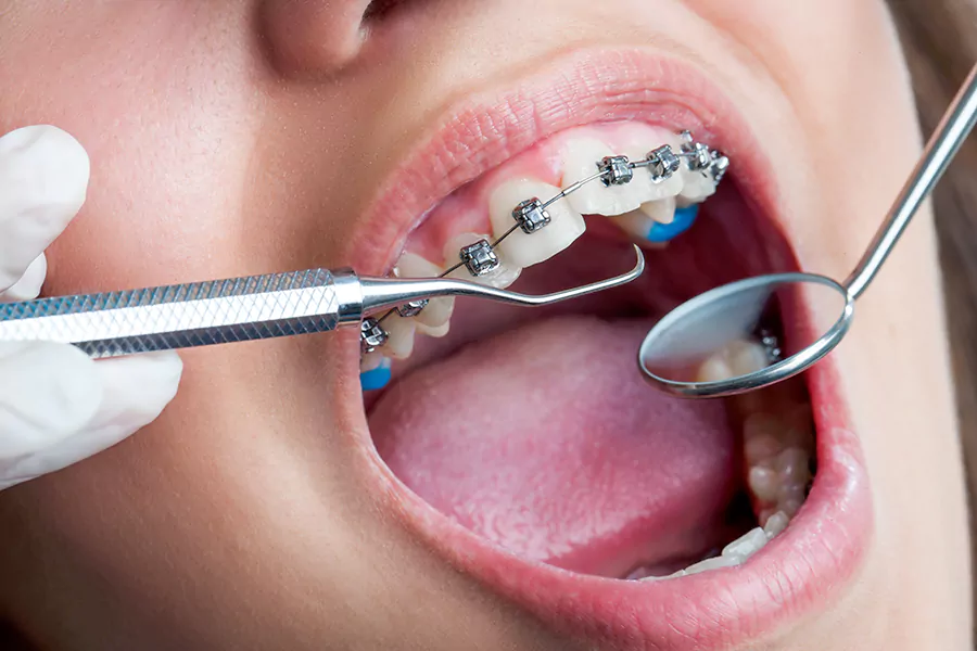 نوع و شدت مشکل دندان
