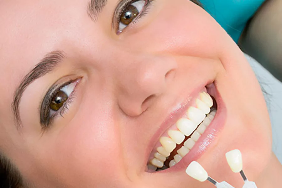 سن مناسب برای کامپوزیت دندان