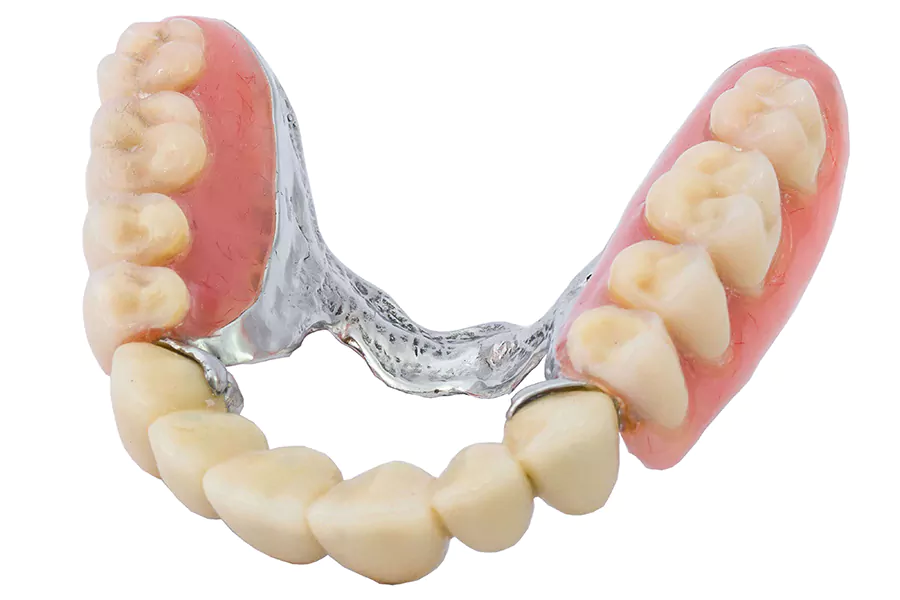 هزینه پروتز دندانی در کلینیک لبخند درمان