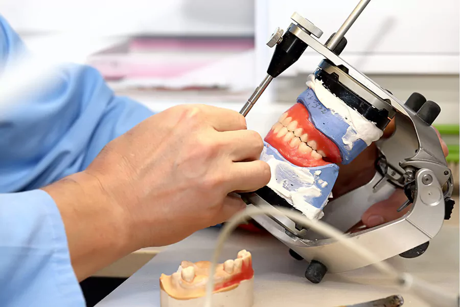 فرایند ساخت پروتز دندان