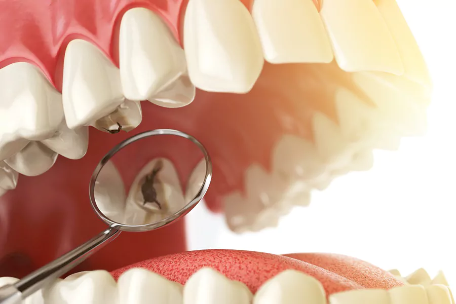 هزینه ترمیم دندان در کلینیک لبخند درمان