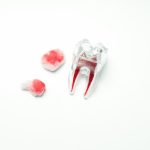 قطع فوری خونریزی دندان