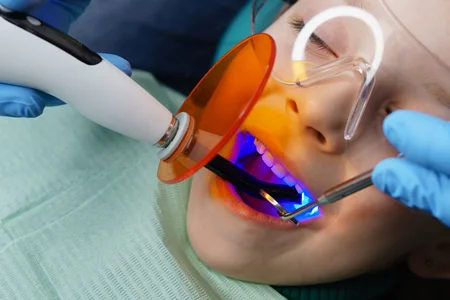 خدمات دندانپزشکی کودک تحت بیهوشی