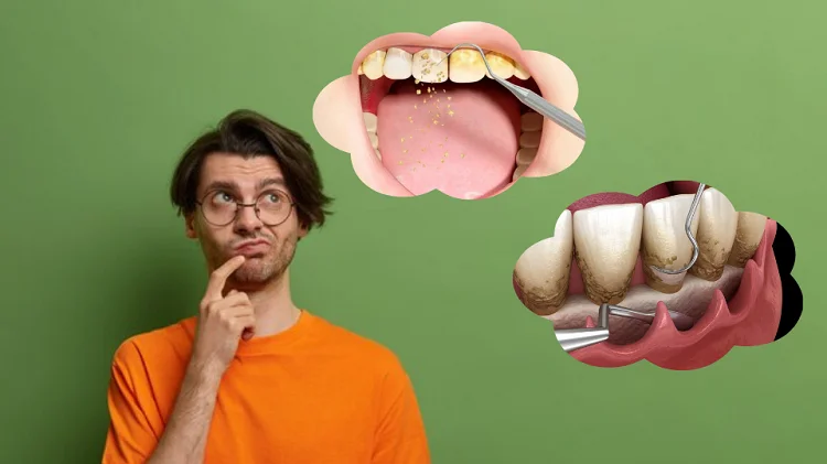 درد جرم گیری دندان بیشتر است یا جرمگیری لثه