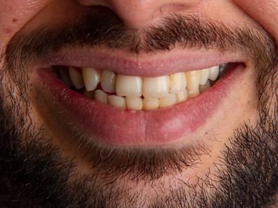 قبل از انجام کار