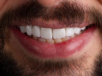 بعد از انجام کار